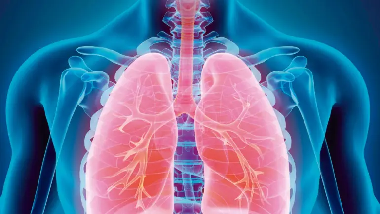 Fibrosis Pulmonar